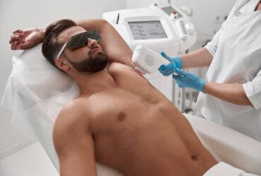 épilation laser homme