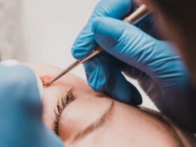 grain de beauté qui gratte