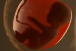 gestation
