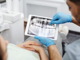 Illustration sobre pour un article sur photo abcès dentaire, sans image choquante ni promesse médicale